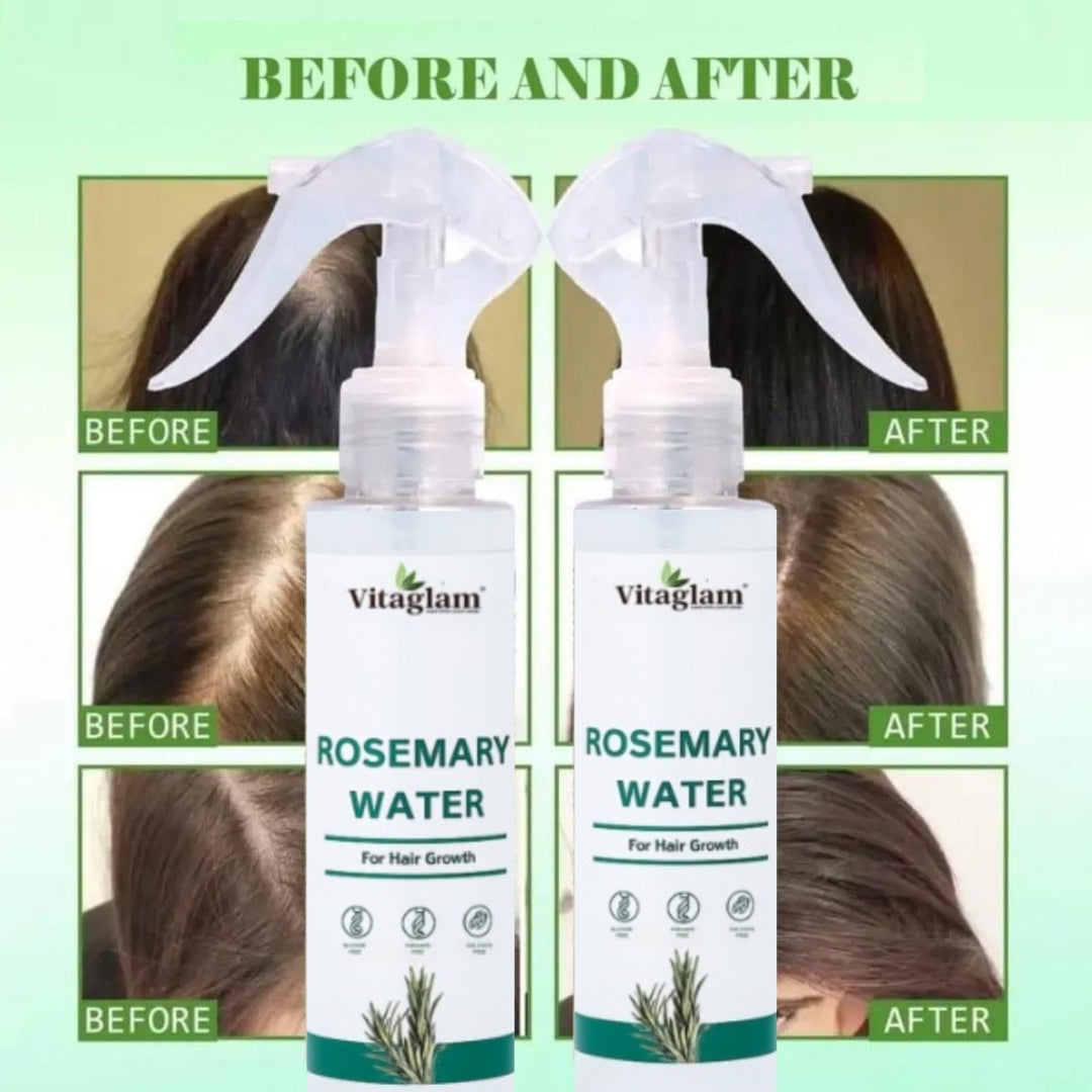 Rosemary Water Spray for Hair Regrowth | Hair Fall Control | Scalp Treatment